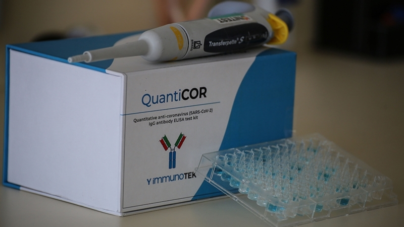 Türk bilim insanları yerli ve milli antikor test kiti geliştirdi